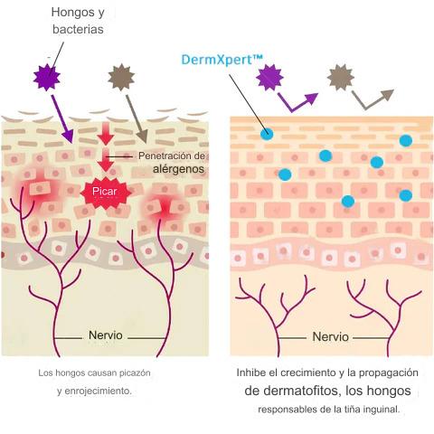 🚨OFERTA 2X1 !! Crema DermXpert para el tratamiento de la picazón, dermatitis, enrojecimiento, irritación⭕