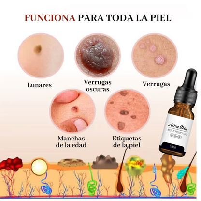 Removedor de Verrugas ClearSkin