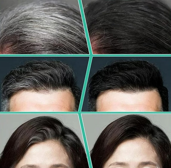Barra para cubrir canas PerfectHair – ROSLAND